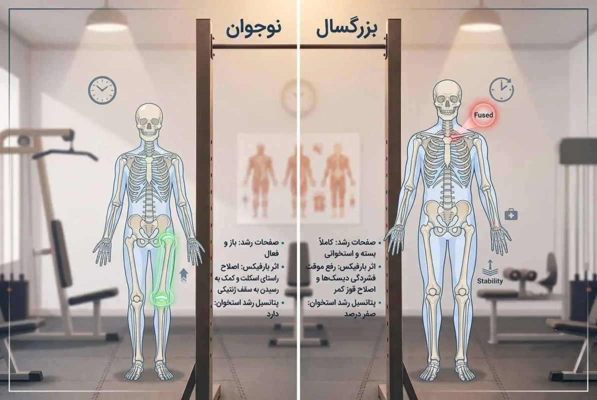 مقایسه بزرگسال و نوجوان در افزایش قد با بارفیکس